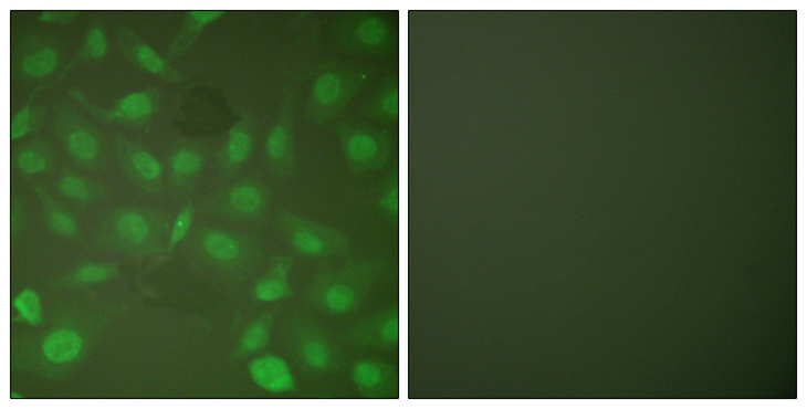 C/EBP Beta / CEBPB Antibody - Immunofluorescence analysis of HepG2 cells, using C/EBP-beta (Phospho-Thr235/188) Antibody. The picture on the right is blocked with the phospho peptide.