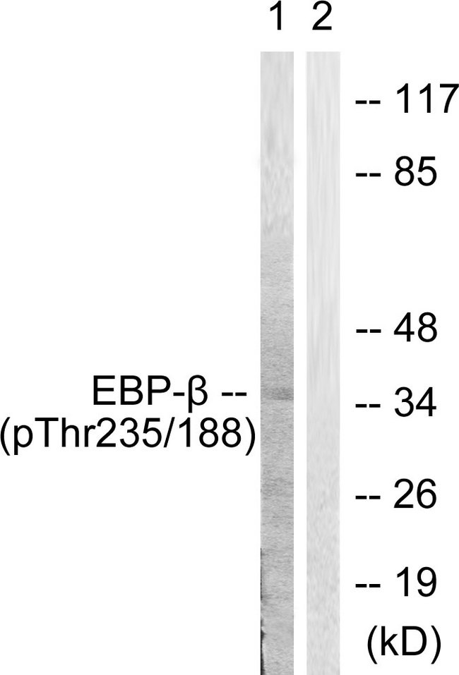 C/EBP Beta / CEBPB Antibody - Western blot analysis of lysates from HepG2 cells treated with EGF 200ng/ml 30', using C/EBP-beta (Phospho-Thr235/188) Antibody. The lane on the right is blocked with the phospho peptide.