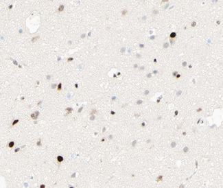 C/EBP Beta / CEBPB Antibody - 1:100 staining human brain tissue by IHC-P. The tissue was formaldehyde fixed and a heat mediated antigen retrieval step in citrate buffer was performed. The tissue was then blocked and incubated with the antibody for 1.5 hours at 22°C. An HRP conjugated goat anti-rabbit antibody was used as the secondary.