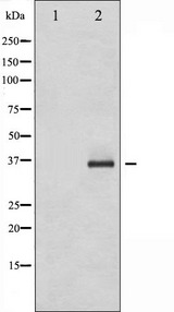 C/EBP Beta / CEBPB Antibody - Western blot analysis of C/EBP-beta phosphorylation expression in HepG2 whole cells lysates. The lane on the left is treated with the antigen-specific peptide.