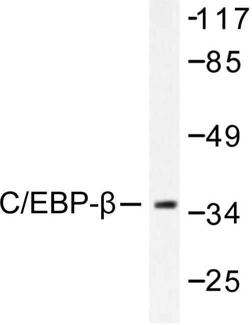 C/EBP Beta / CEBPB Antibody - Western blot of C/EBP- (S229/182) pAb in extracts from NIH/3T3 cells.
