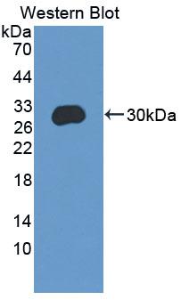 C/EBP Delta / CEBPD Antibody - Western Blot; Sample: Recombinant protein.
