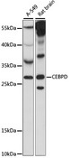 C/EBP Delta / CEBPD Antibody - Western blot analysis of extracts of various cell lines, using CEBPD antibody at 1:1000 dilution. The secondary antibody used was an HRP Goat Anti-Rabbit IgG (H+L) at 1:10000 dilution. Lysates were loaded 25ug per lane and 3% nonfat dry milk in TBST was used for blocking. An ECL Kit was used for detection and the exposure time was 90S.
