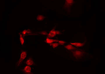 C/EBP Delta / CEBPD Antibody - Staining LOVO cells by IF/ICC. The samples were fixed with PFA and permeabilized in 0.1% Triton X-100, then blocked in 10% serum for 45 min at 25°C. The primary antibody was diluted at 1:200 and incubated with the sample for 1 hour at 37°C. An Alexa Fluor 594 conjugated goat anti-rabbit IgG (H+L) Ab, diluted at 1/600, was used as the secondary antibody.