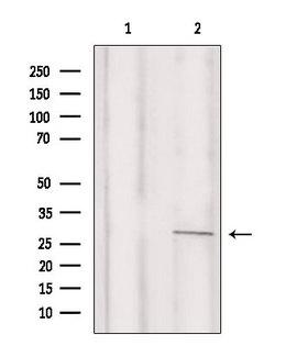 C/EBP Delta / CEBPD Antibody - Western blot analysis of extracts of mouse brain tissue using C/EBP d/e antibody. Lane 1 was treated with the blocking peptide.