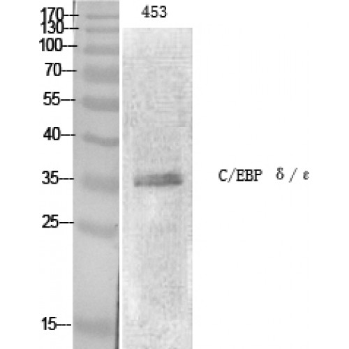 C/EBP Epsilon / CEBPE Antibody - Western blot of C/EBP epsilon antibody