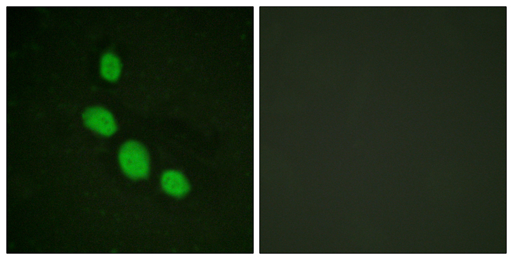 C/EBP Epsilon / CEBPE Antibody - Immunofluorescence analysis of HeLa cells, using C/EBP-epsilon Antibody. The picture on the right is blocked with the synthesized peptide.