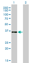 C/EBP Epsilon / CEBPE Antibody - Western Blot analysis of CEBPE expression in transfected 293T cell line by CEBPE monoclonal antibody (M01), clone 7A4.Lane 1: CEBPE transfected lysate(30.6 KDa).Lane 2: Non-transfected lysate.