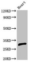 C/EBP Epsilon / CEBPE Antibody - Western Blot Positive WB detected in:Rat heart tissue All Lanes:CEBPE antibody at 2.7µg/ml Secondary Goat polyclonal to rabbit IgG at 1/50000 dilution Predicted band size: 31 KDa Observed band size: 31 KDa