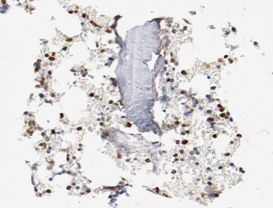 C/EBP Epsilon / CEBPE Antibody - 1:200 staining human Bone marrow tissue by IHC-P. The tissue was formaldehyde fixed and a heat mediated antigen retrieval step in citrate buffer was performed. The tissue was then blocked and incubated with the antibody for 1.5 hours at 22°C. An HRP conjugated goat anti-rabbit antibody was used as the secondary.