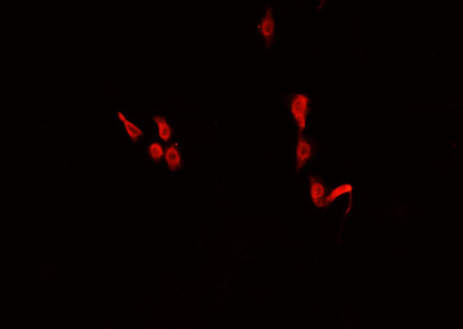 C/EBP Epsilon / CEBPE Antibody - Staining HuvEc cells by IF/ICC. The samples were fixed with PFA and permeabilized in 0.1% Triton X-100, then blocked in 10% serum for 45 min at 25°C. The primary antibody was diluted at 1:200 and incubated with the sample for 1 hour at 37°C. An Alexa Fluor 594 conjugated goat anti-rabbit IgG (H+L) Ab, diluted at 1/600, was used as the secondary antibody.