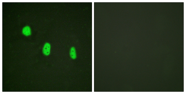 C/EBP Epsilon / CEBPE Antibody - Immunofluorescence analysis of HeLa cells, using C/EBP-epsilon (Phospho-Thr74) Antibody. The picture on the right is blocked with the phospho peptide.