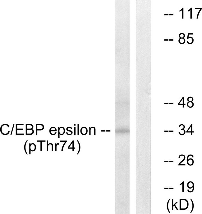 C/EBP Epsilon / CEBPE Antibody - Western blot analysis of lysates from HUVEC cells treated with UV 15', using C/EBP-epsilon (Phospho-Thr74) Antibody. The lane on the right is blocked with the phospho peptide.