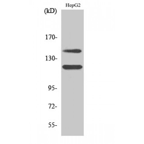c-Kit / CD117 Antibody - Western blot of Phospho-c-Kit (Y721) antibody