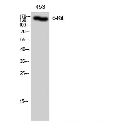 c-Kit / CD117 Antibody - Western blot of c-Kit antibody