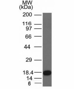 c-Kit / CD117 Antibody - Western blot of a recombinant protein fragment with c-Kit antibody (KIT/982).  This image was taken for the unmodified form of this product. Other forms have not been tested.