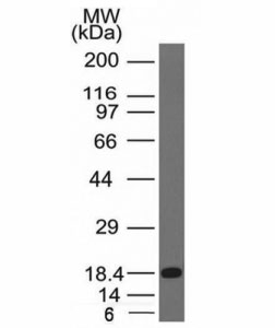 c-Kit / CD117 Antibody - Western blot of a recombinant protein fragment with c-Kit antibody (KIT/983).  This image was taken for the unmodified form of this product. Other forms have not been tested.