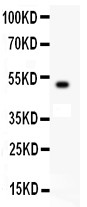 c-Kit / CD117 Antibody - C-Kit antibody Western blot. All lanes: Anti C-Kit at 0.5 ug/ml. WB: Recombinant Human C-Kit Protein 0.5ng. Predicted band size: 49 kD. Observed band size: 49 kD.