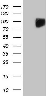 c-Kit / CD117 Antibody - HEK293T cells were transfected with the pCMV6-ENTRY control. (Left lane) or pCMV6-ENTRY KIT. (Right lane) cDNA for 48 hrs and lysed. Equivalent amounts of cell lysates. (5 ug per lane) were separated by SDS-PAGE and immunoblotted with anti-KIT. (1:2000)