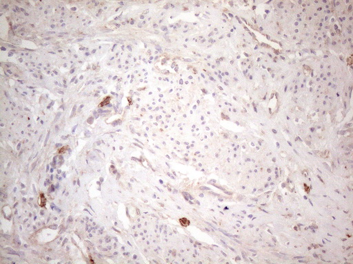 c-Kit / CD117 Antibody - Immunohistochemical staining of paraffin-embedded Human endometrium tissue within the normal limits using anti-KIT mouse monoclonal antibody. (Heat-induced epitope retrieval by 1mM EDTA in 10mM Tris buffer. (pH8.5) at 120°C for 3 min. (1:150)