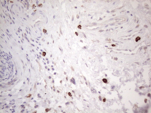 c-Kit / CD117 Antibody - Immunohistochemical staining of paraffin-embedded Human bladder tissue within the normal limits using anti-KIT mouse monoclonal antibody. (Heat-induced epitope retrieval by 1mM EDTA in 10mM Tris buffer. (pH8.5) at 120°C for 3 min. (1:150)