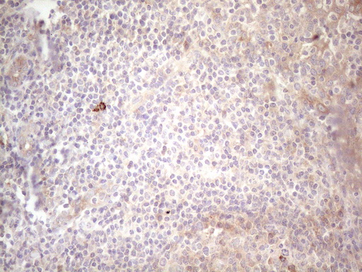 c-Kit / CD117 Antibody - Immunohistochemical staining of paraffin-embedded Human tonsil within the normal limits using anti-KIT mouse monoclonal antibody. (Heat-induced epitope retrieval by 1mM EDTA in 10mM Tris buffer. (pH8.5) at 120°C for 3 min. (1:150)