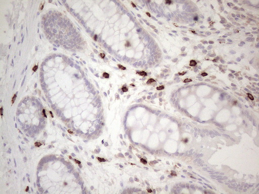 c-Kit / CD117 Antibody - Immunohistochemical staining of paraffin-embedded Human colon tissue within the normal limits using anti-KIT mouse monoclonal antibody. (Heat-induced epitope retrieval by 1mM EDTA in 10mM Tris buffer. (pH8.5) at 120°C for 3 min. (1:150)