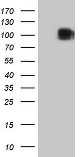 c-Kit / CD117 Antibody - HEK293T cells were transfected with the pCMV6-ENTRY control. (Left lane) or pCMV6-ENTRY KIT. (Right lane) cDNA for 48 hrs and lysed