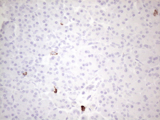 c-Kit / CD117 Antibody - Immunohistochemical staining of paraffin-embedded Human pancreas tissue within the normal limits using anti-KIT mouse monoclonal antibody. (Heat-induced epitope retrieval by 1mM EDTA in 10mM Tris buffer. (pH8.5) at 120°C for 3 min. (1:150)