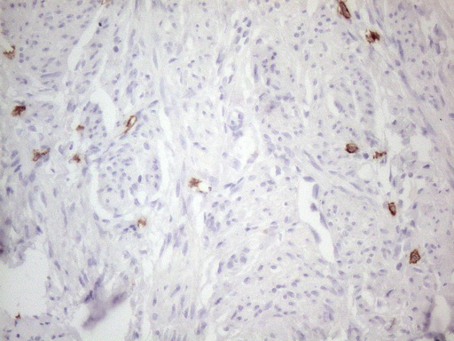 c-Kit / CD117 Antibody - Immunohistochemical staining of paraffin-embedded Human endometrium tissue within the normal limits using anti-KIT mouse monoclonal antibody. (Heat-induced epitope retrieval by 1mM EDTA in 10mM Tris buffer. (pH8.5) at 120°C for 3 min. (1:150)