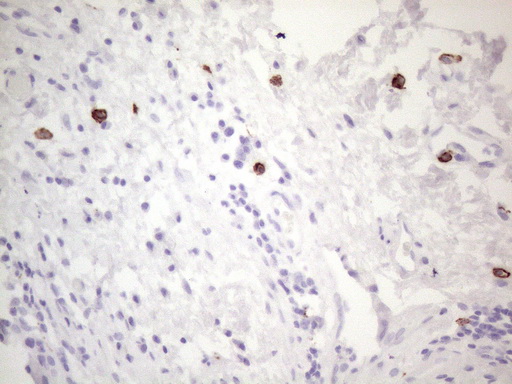 c-Kit / CD117 Antibody - Immunohistochemical staining of paraffin-embedded Human bladder tissue within the normal limits using anti-KIT mouse monoclonal antibody. (Heat-induced epitope retrieval by 1mM EDTA in 10mM Tris buffer. (pH8.5) at 120°C for 3 min. (1:150)