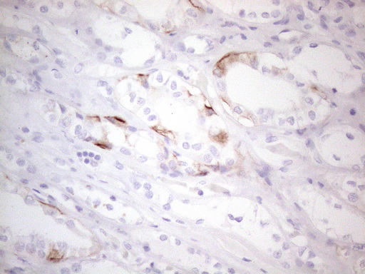 c-Kit / CD117 Antibody - Immunohistochemical staining of paraffin-embedded Human Kidney tissue within the normal limits using anti-KIT mouse monoclonal antibody. (Heat-induced epitope retrieval by 1mM EDTA in 10mM Tris buffer. (pH8.5) at 120°C for 3 min. (1:150)