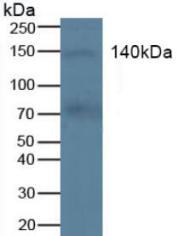 c-Kit / CD117 Antibody - Western Blot; Sample: Human Blood Cells.