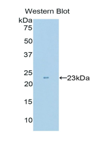 c-Kit / CD117 Antibody - Western blot of recombinant c-Kit / CD117.  This image was taken for the unconjugated form of this product. Other forms have not been tested.