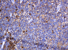 c-Kit / CD117 Antibody - IHC of paraffin-embedded Human lymph node tissue using anti-KIT mouse monoclonal antibody. (Heat-induced epitope retrieval by 10mM citric buffer, pH6.0, 120°C for 3min).
