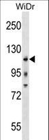 c-Kit / CD117 Antibody - KIT Antibody (Center Y568/Y570)western blot of WiDr cell line lysates (35 ug/lane). The KIT antibody detected the KIT protein (arrow).