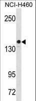 c-Kit / CD117 Antibody - KIT Antibody (S746) western blot of NCI-H460 cell line lysates (35 ug/lane). The KIT antibody detected the KIT protein (arrow).