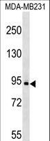 c-Kit / CD117 Antibody - KIT Antibody (C-term S821/Y823) western blot of MDA-MB231 cell line lysates (35 ug/lane). The KIT antibody detected the KIT protein (arrow).