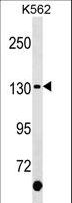 c-Kit / CD117 Antibody - KIT Antibody (C-term Y900)western blot of K562 cell line lysates (35 ug/lane). The KIT antibody detected the KIT protein (arrow).
