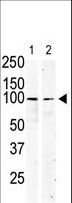 c-Kit / CD117 Antibody - The anti-KIT antibody is used in Western blot to detect KIT in serum-starved HeLa cell lysate (lane 1) and primate testis tissue lysate (lane 2).