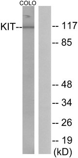 c-Kit / CD117 Antibody - Western blot analysis of lysates from COLO205 cells, using KIT Antibody. The lane on the right is blocked with the synthesized peptide.