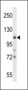 c-Kit / CD117 Antibody - KIT Antibody (Q927) western blot of mouse cerebellum tissue lysates (35 ug/lane). The KIT antibody detected the KIT protein (arrow).