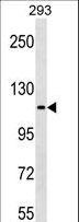 c-Kit / CD117 Antibody - KIT Antibody (C-term Y936)western blot of 293 cell line lysates (35 ug/lane). The KIT antibody detected the KIT protein (arrow).