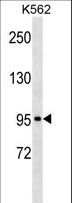 c-Kit / CD117 Antibody - KIT Antibody (C-term S959)western blot of K562 cell line lysates (35 ug/lane). The KIT antibody detected the KIT protein (arrow).
