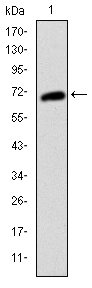 c-Kit / CD117 Antibody - Western blot using KIT monoclonal antibody against human KIT (AA: 805-976) recombinant protein. (Expected MW is 45 kDa)