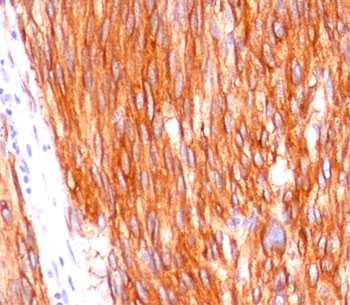 c-Kit / CD117 Antibody - CD117 antibody C117/370 immunohistochemistry.  This image was taken for the unmodified form of this product. Other forms have not been tested.