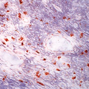 c-Kit / CD117 Antibody - Frozen human tonsil section stained UltraVision LP and AEC chromogen. Note staining of mast cells.  This image was taken for the unmodified form of this product. Other forms have not been tested.