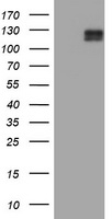 c-Kit / CD117 Antibody - HEK293T cells were transfected with the pCMV6-ENTRY control (Left lane) or pCMV6-ENTRY KIT (Right lane) cDNA for 48 hrs and lysed. Equivalent amounts of cell lysates (5 ug per lane) were separated by SDS-PAGE and immunoblotted with anti-KIT.