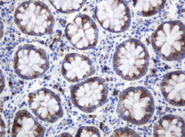 c-Kit / CD117 Antibody - IHC of paraffin-embedded Human colon tissue using anti-KIT mouse monoclonal antibody.