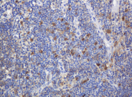 c-Kit / CD117 Antibody - IHC of paraffin-embedded Human lymph node tissue using anti-KIT mouse monoclonal antibody.